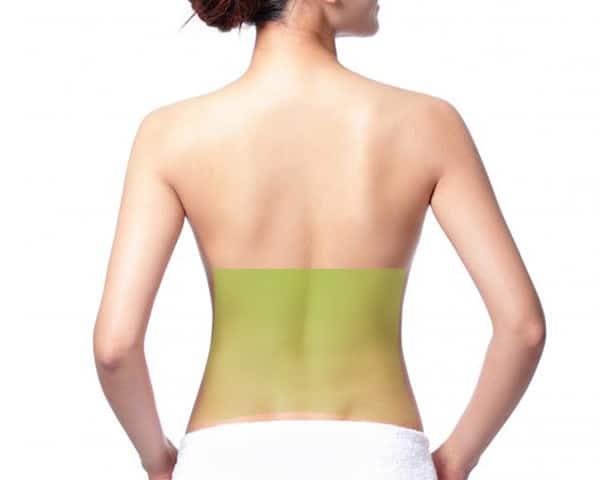 Laser Lower Back Woman